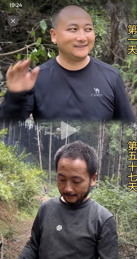 原来如此，看来果然是有一定的科学道理的……毕竟，你见过哪个讨饭的秃顶的[大笑]…