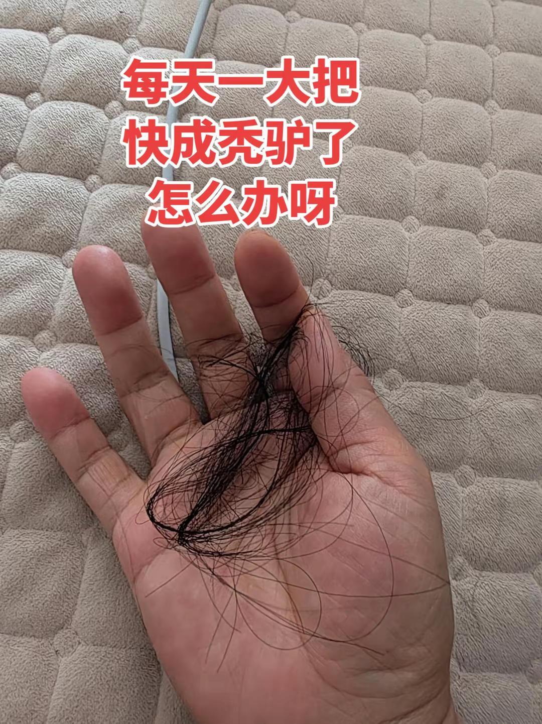 为什么不好好在头顶待着啊
