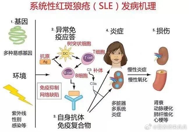 #周海媚##红斑狼疮##健闻登顶计划# 系统性红斑狼疮日常注意事项1. 防晒: 
