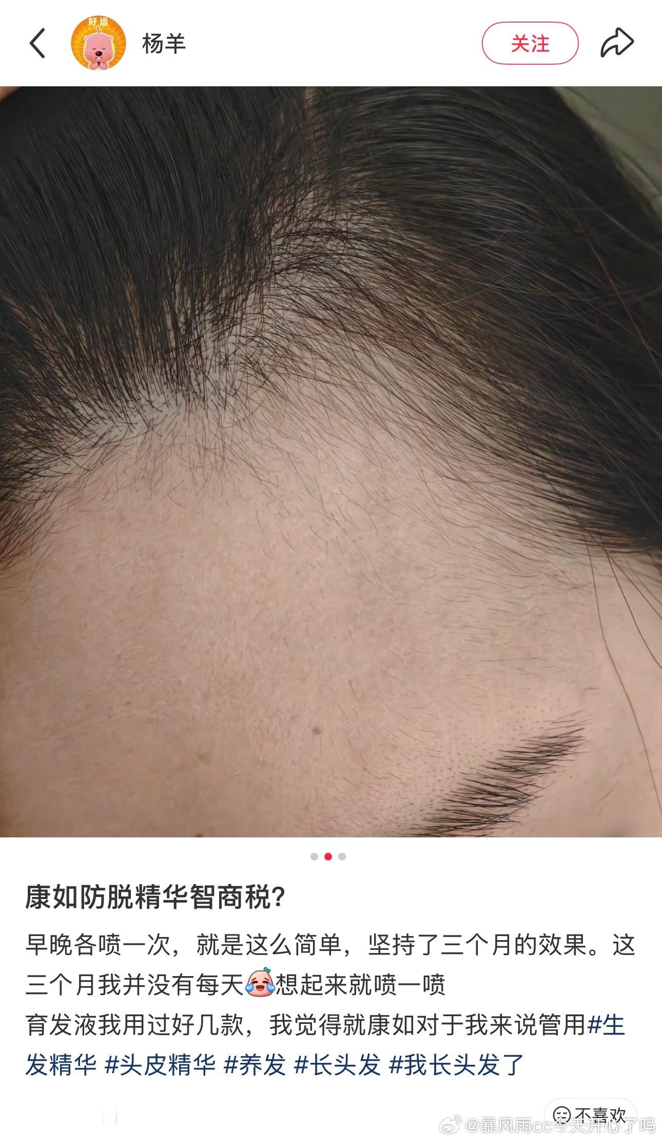 康如的生发防脱喷雾很好用的～主打稳固发根+促生长，掉的少长得多，可不就头发越来越