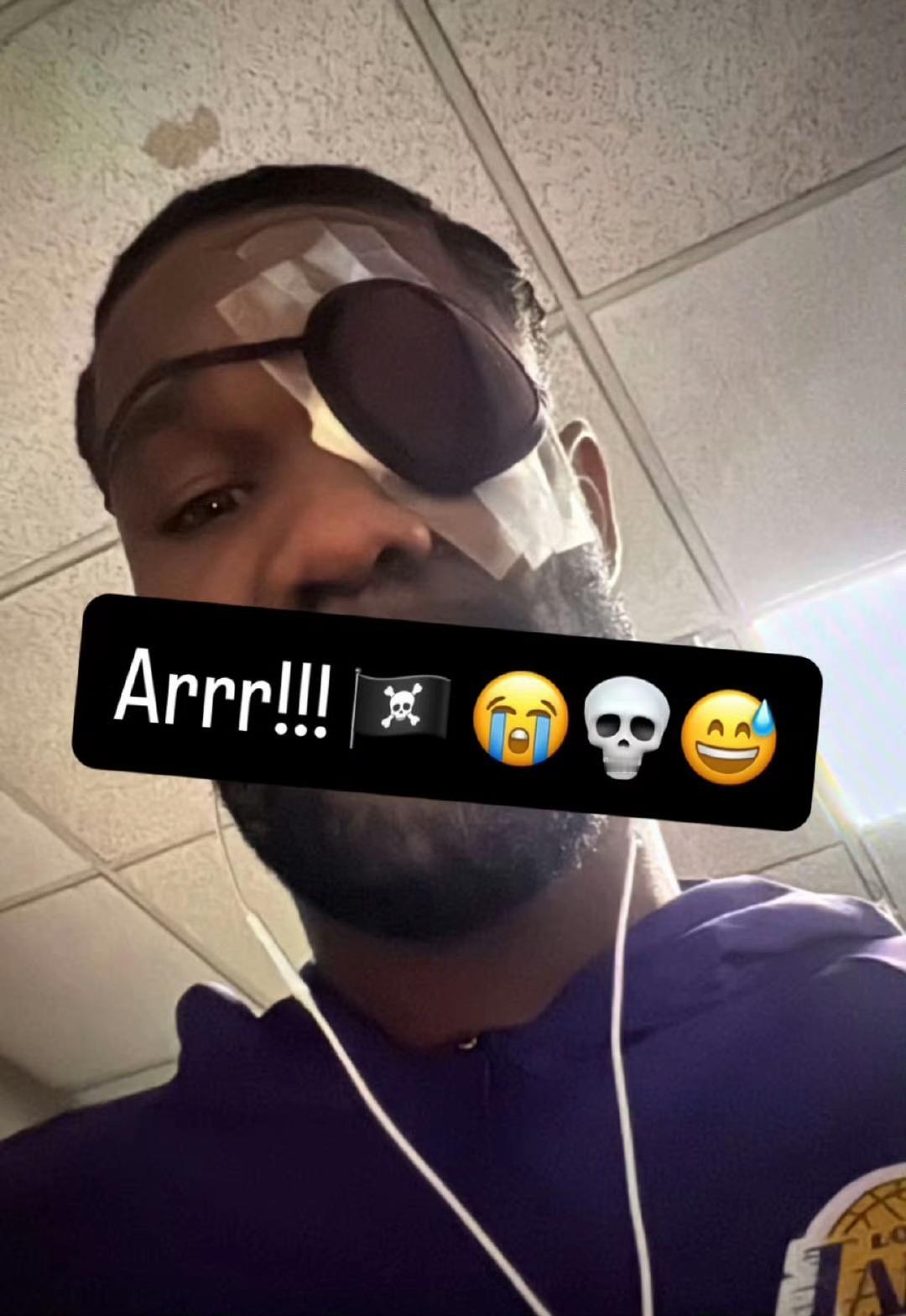 湖人那边消息，艾顿眼睛并没事，明天可以打快船的比赛。

他连伤病名单都没有上，小