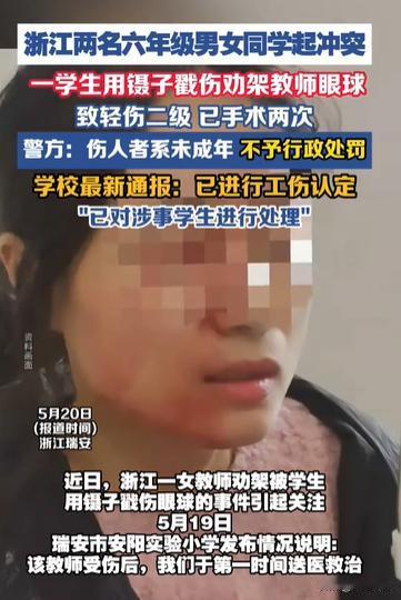 浙江瑞安，两学生打架，女老师劝阻被女生用铁镊子戳入右眼，轻伤二级视力终身受损。伤