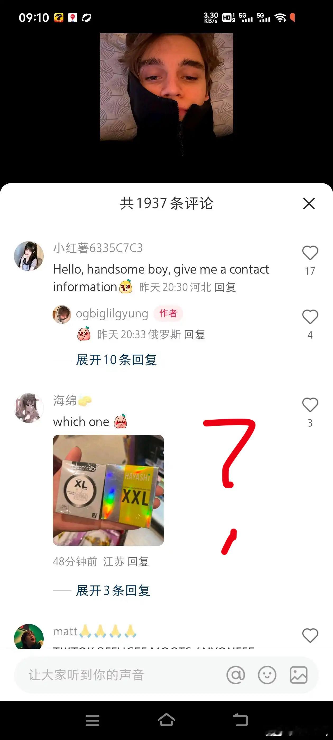 小红薯观察之 which one？ 