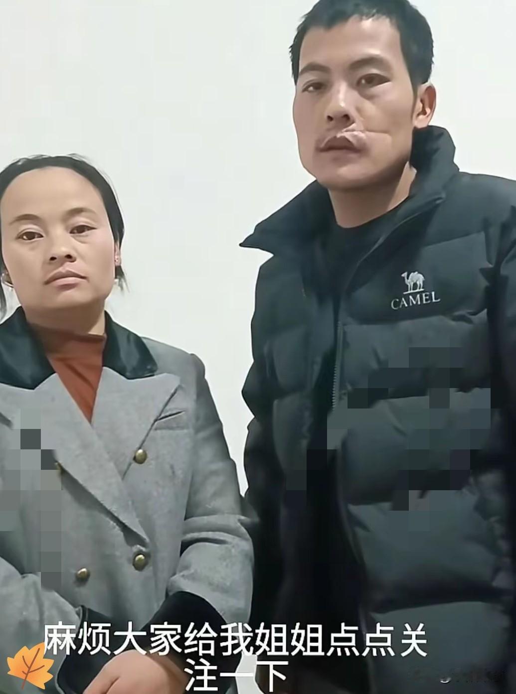 刀疤哥“被流量反噬了”！
本来靠接地气的真实感圈粉无数，结果爆红没两天就急着“全