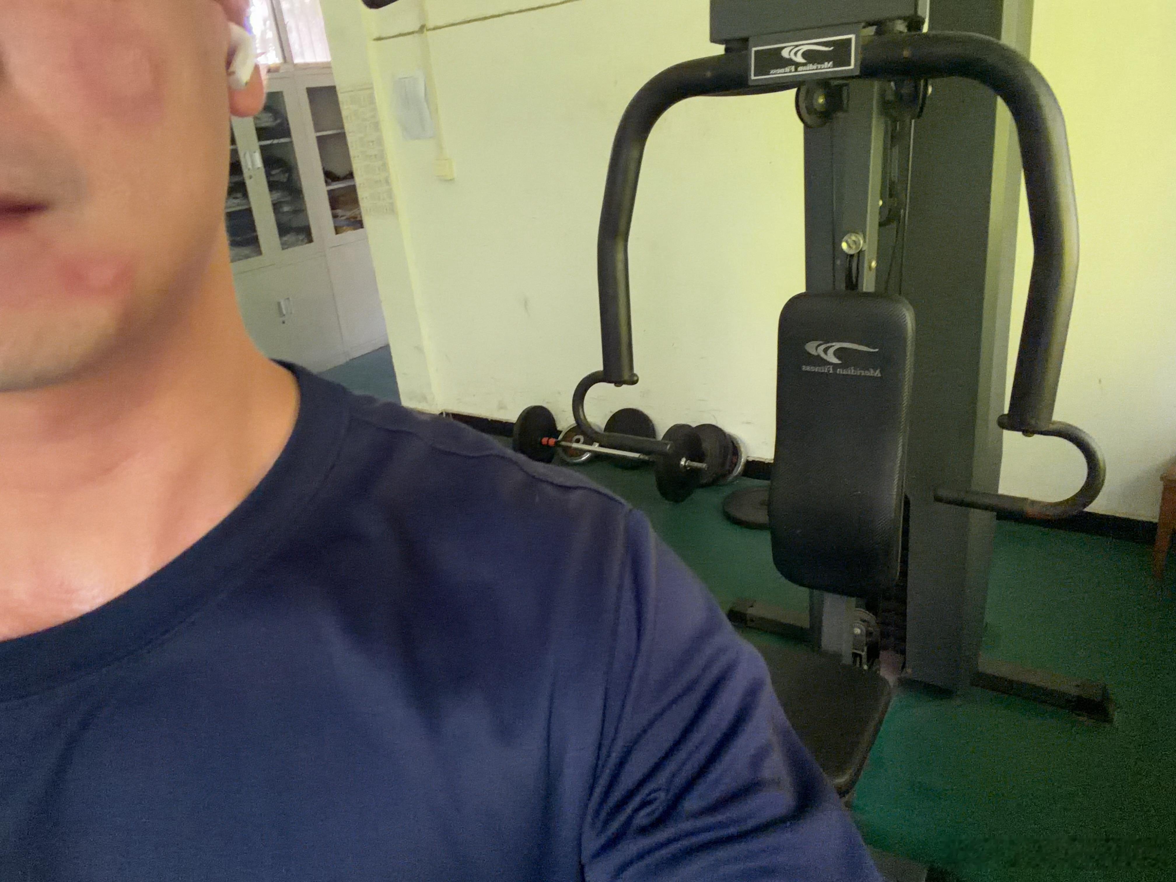 妈的蚊子这么饥渴吗 给我脸上咬两个大包 
