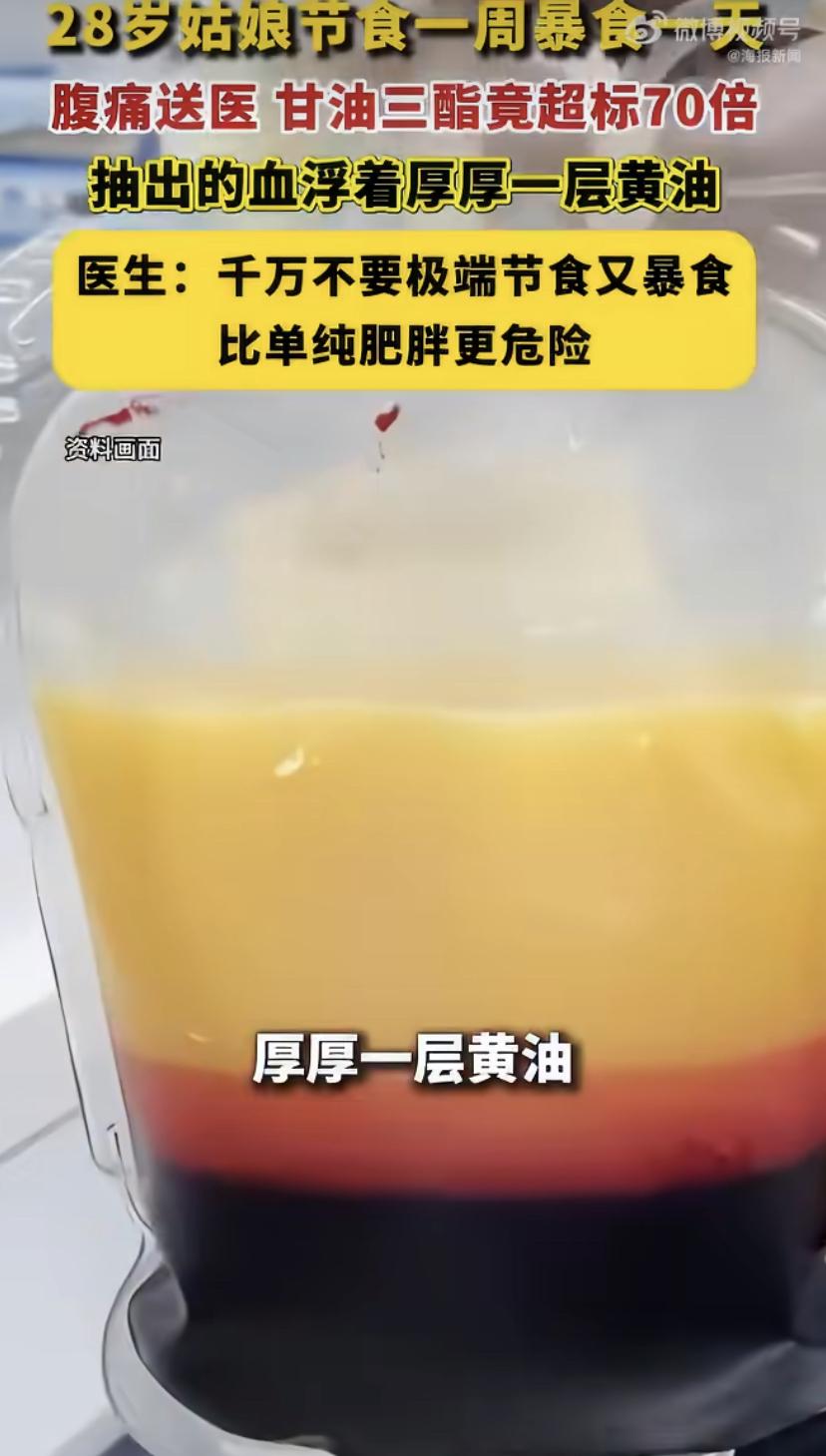杭州28岁姑娘小美，身高1米6、120斤，其实身材挺匀称。可她嫌自己不够瘦，周一