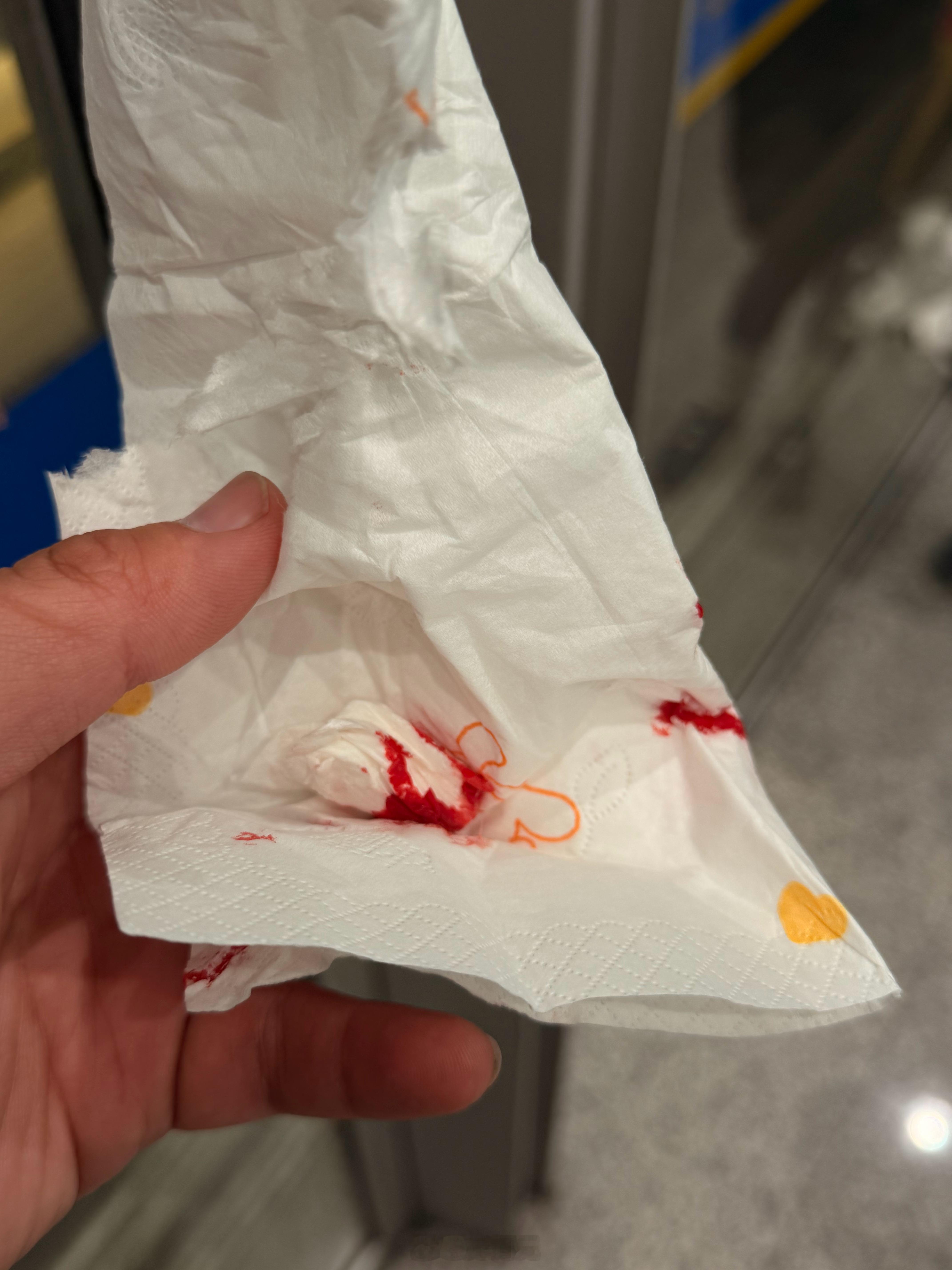 落地北京，立马流鼻血，论冬季干燥还得是北京哈哈哈哈 