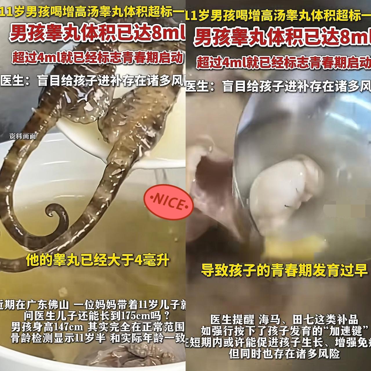 担心的事情还是发生了！
​​
广东佛山一位妈妈怕11岁儿子

长不到175，天天
