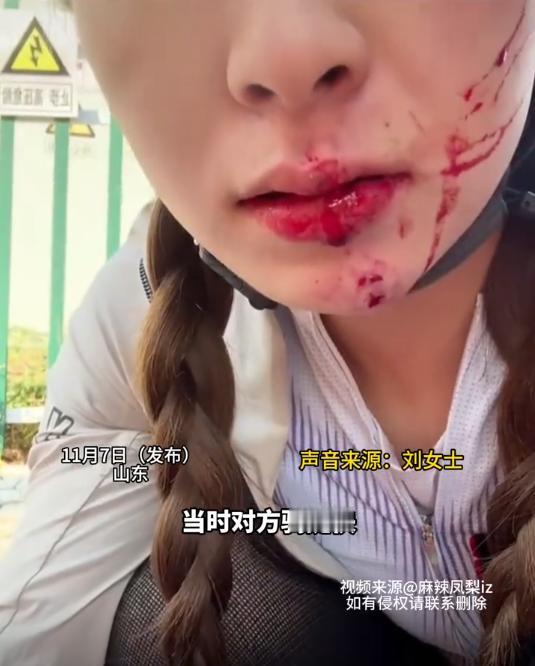 山东，女孩被逆行电动车撞倒在地，流了很多血，牙磕掉半颗，被撞的头晕眼花，没曾想，