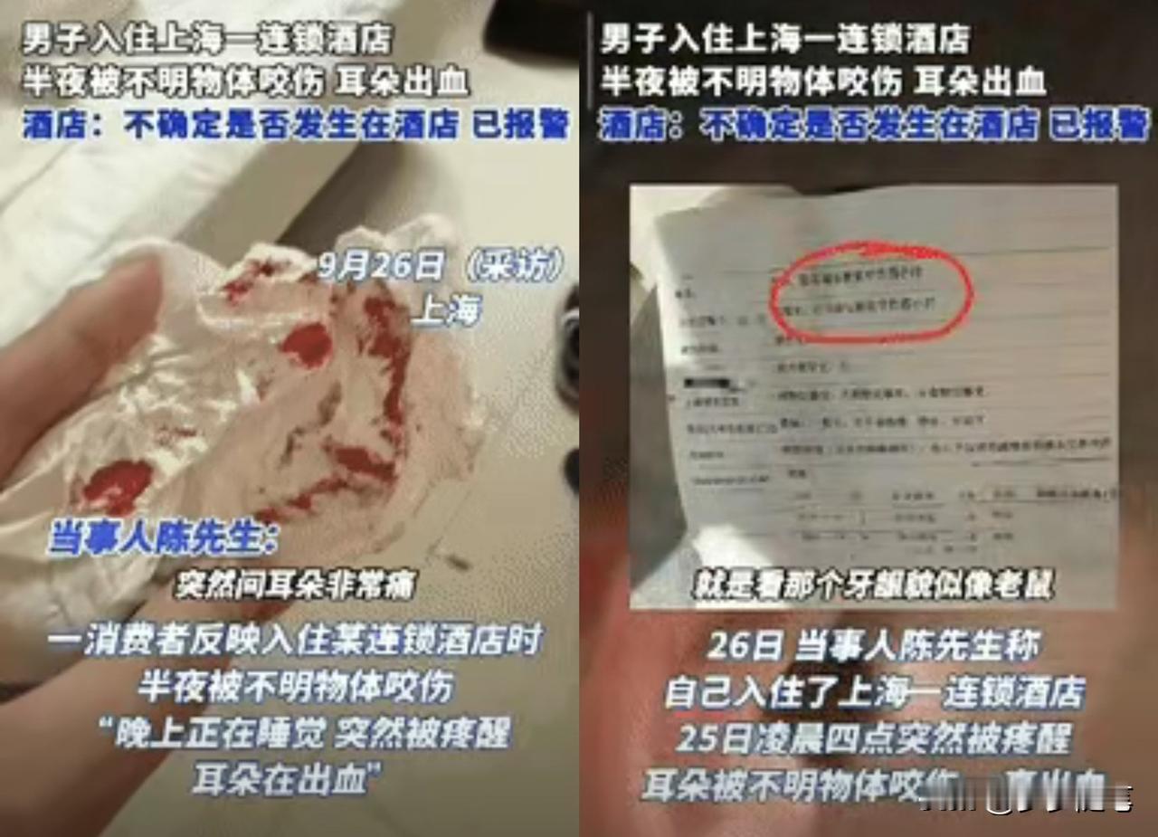 “倒大霉了！”上海一男子半夜在酒店休息时，突然感觉有东西在咬他耳朵，男子猛地张开