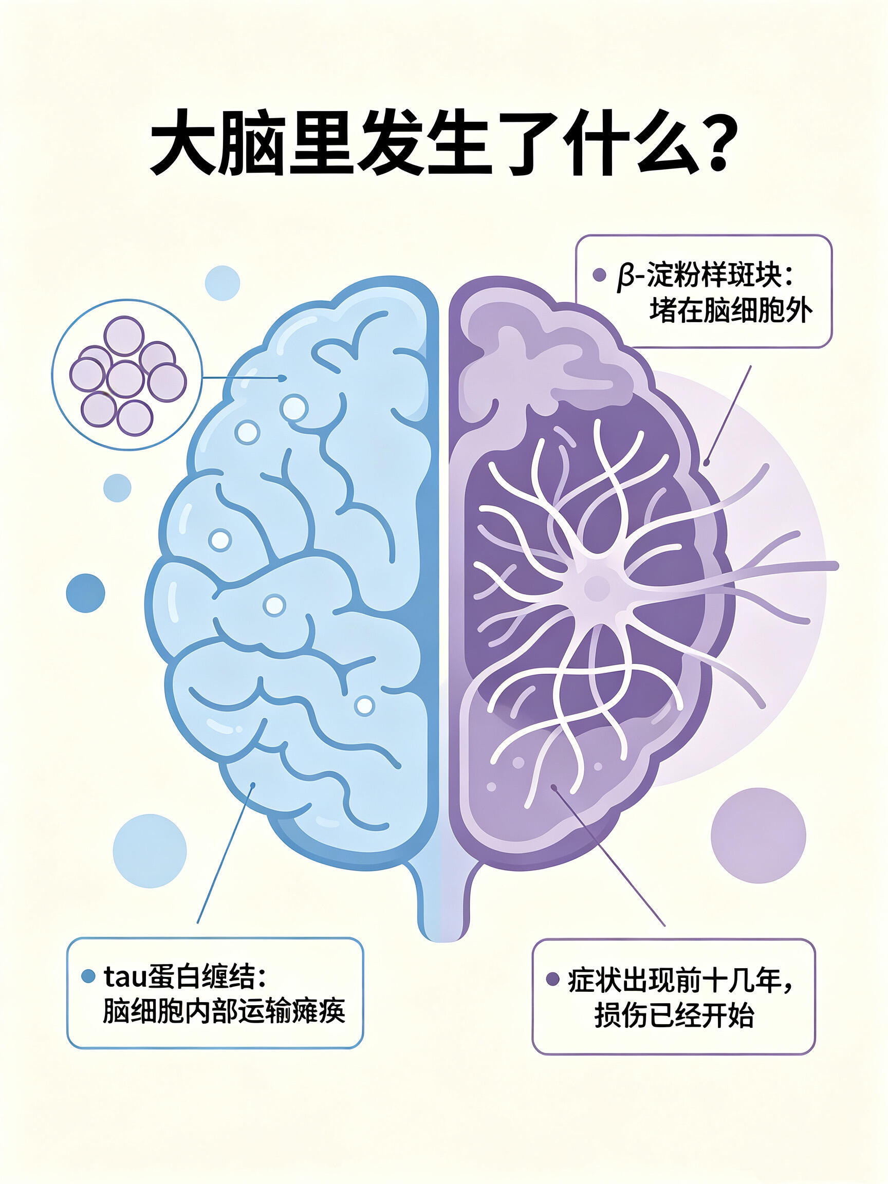75岁奶奶打造自己的数字分身75岁奶奶患阿尔茨海默症后用AI创作不向病症妥协，7