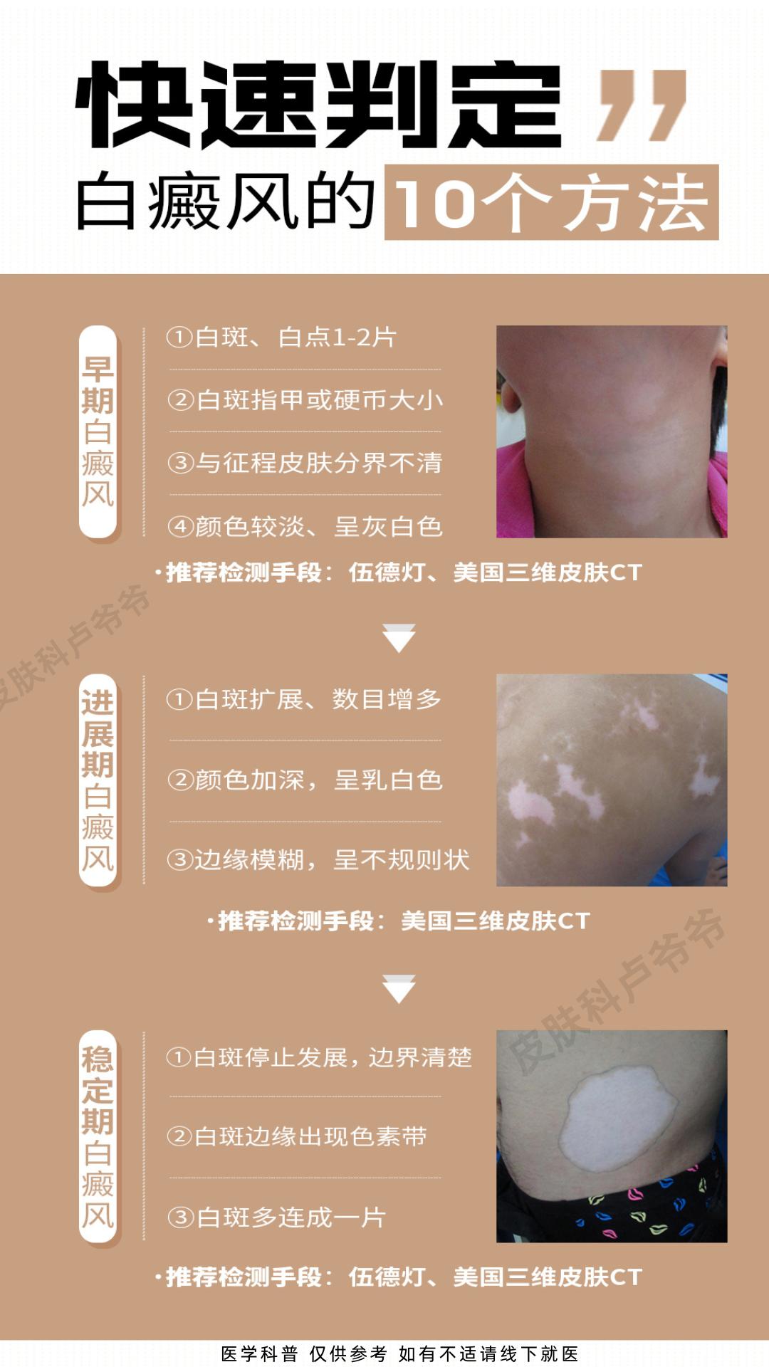 白癜风 白斑 医学科普 江西