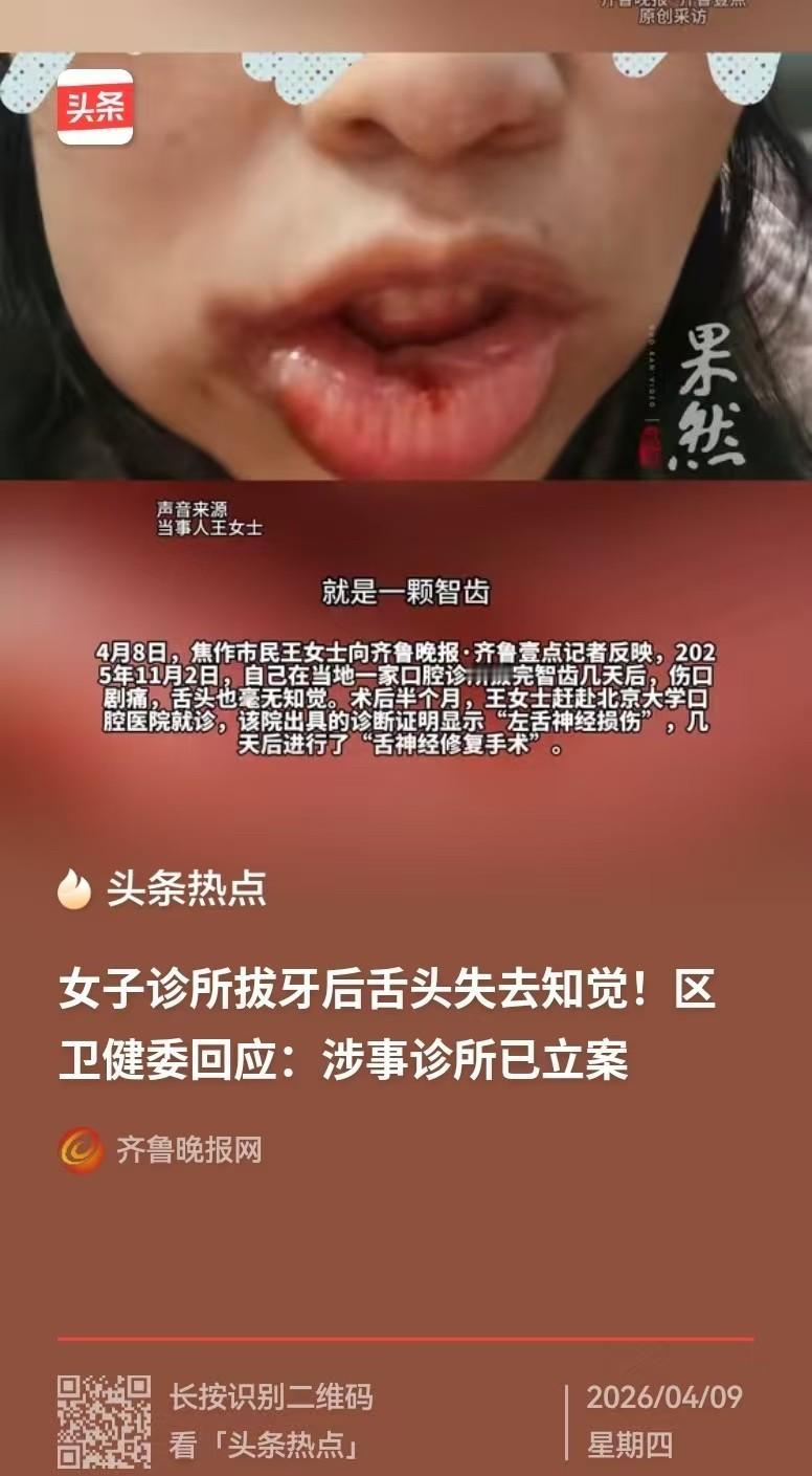 拔牙后舌头没了知觉，

医生说没事，

半年了还在疼。

王女士去年11月在焦作