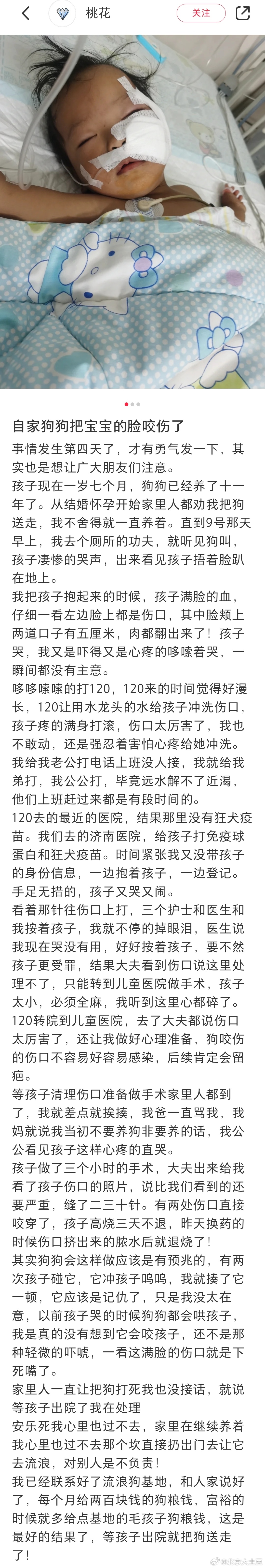 #咬伤女童黑狗的主人被刑拘# 刚又看到一个孩子被自家狗咬伤的，简直无语。 ​​​
