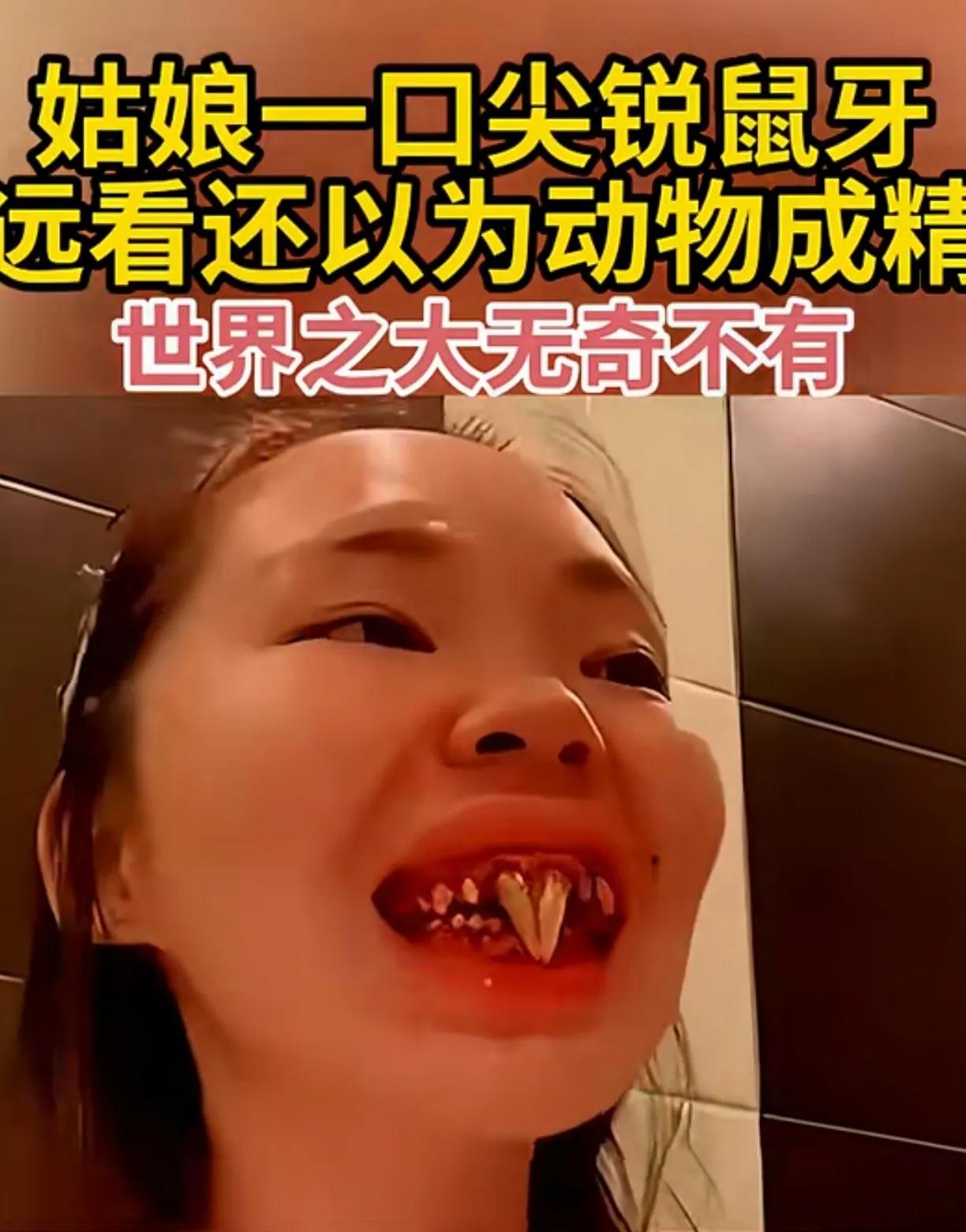 姑娘这一口牙齿，长得太奇特了，像老鼠的牙一样尖锐，这咬一口不得了。