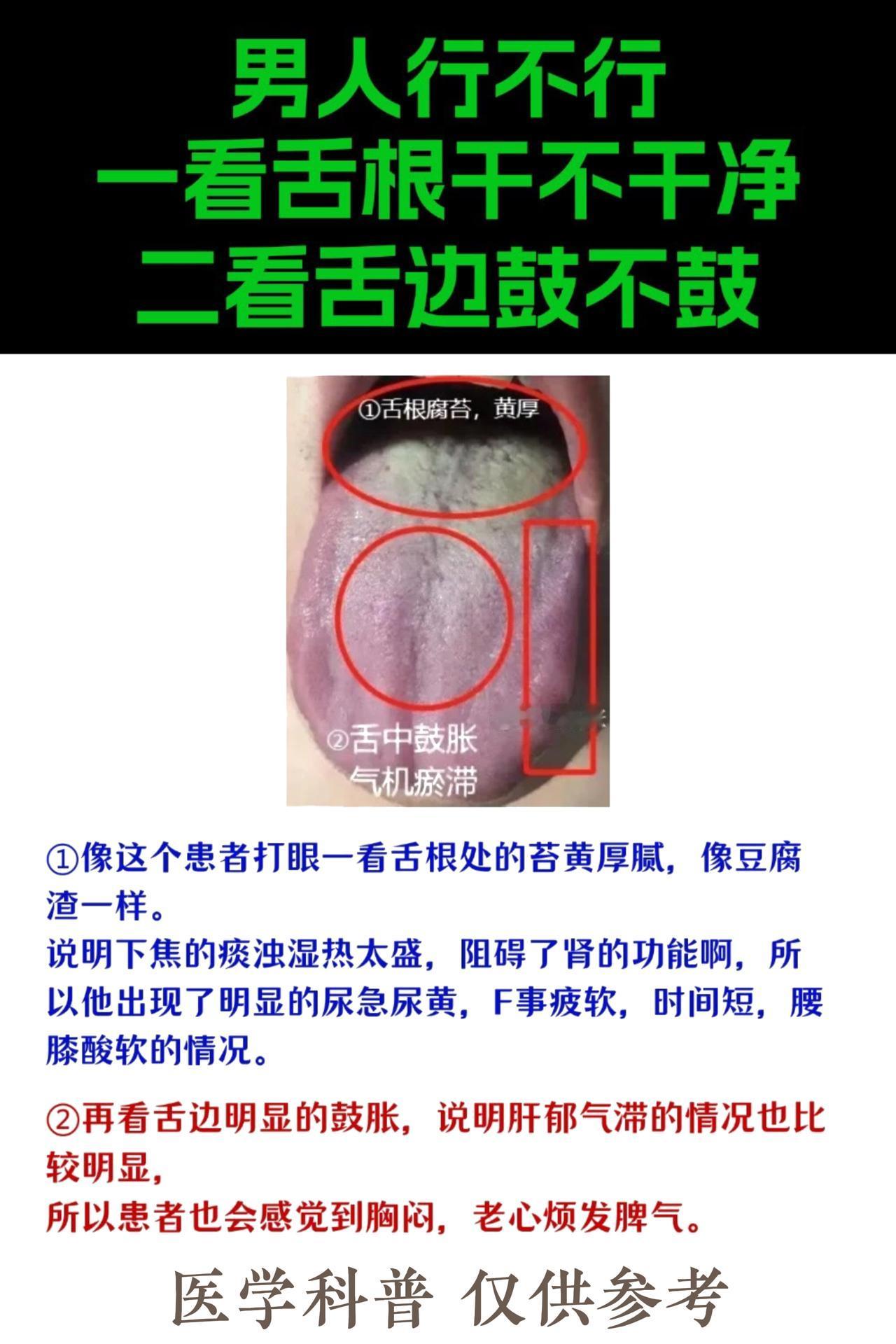男人行不行，就看舌根和舌边！#中医##健康##舌象##舌诊#