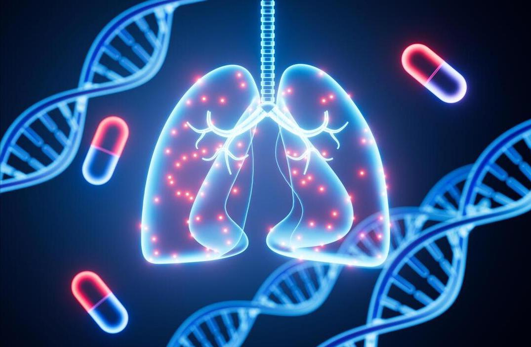 支气管扩张患者最害怕的细菌，是结核菌的小兄弟，治疗起来很麻烦
昨天上门诊遇到一位