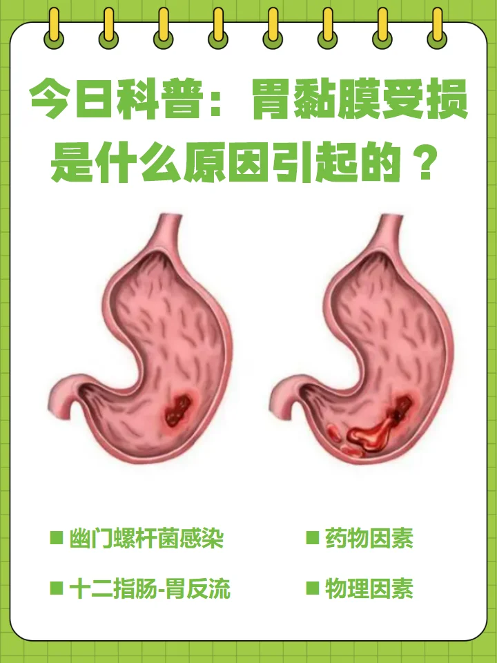 出现胃粘膜受损可能是什么原因引起的？