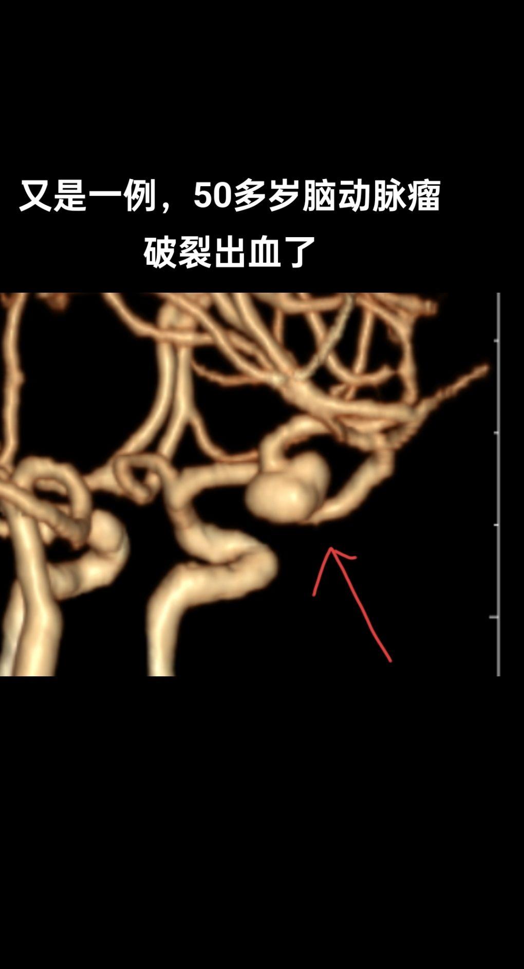 医生日常 医者仁心