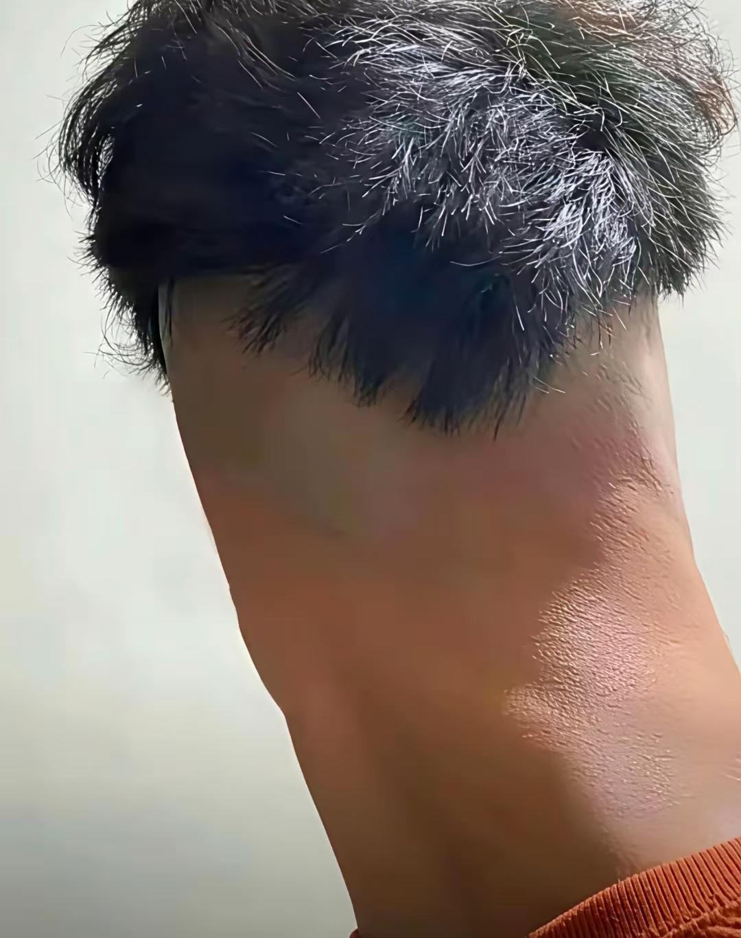 谁懂啊，剪头发翻车现场！托尼老师下手太狠，直接把两侧剃光，只剩头顶一小撮头发。从