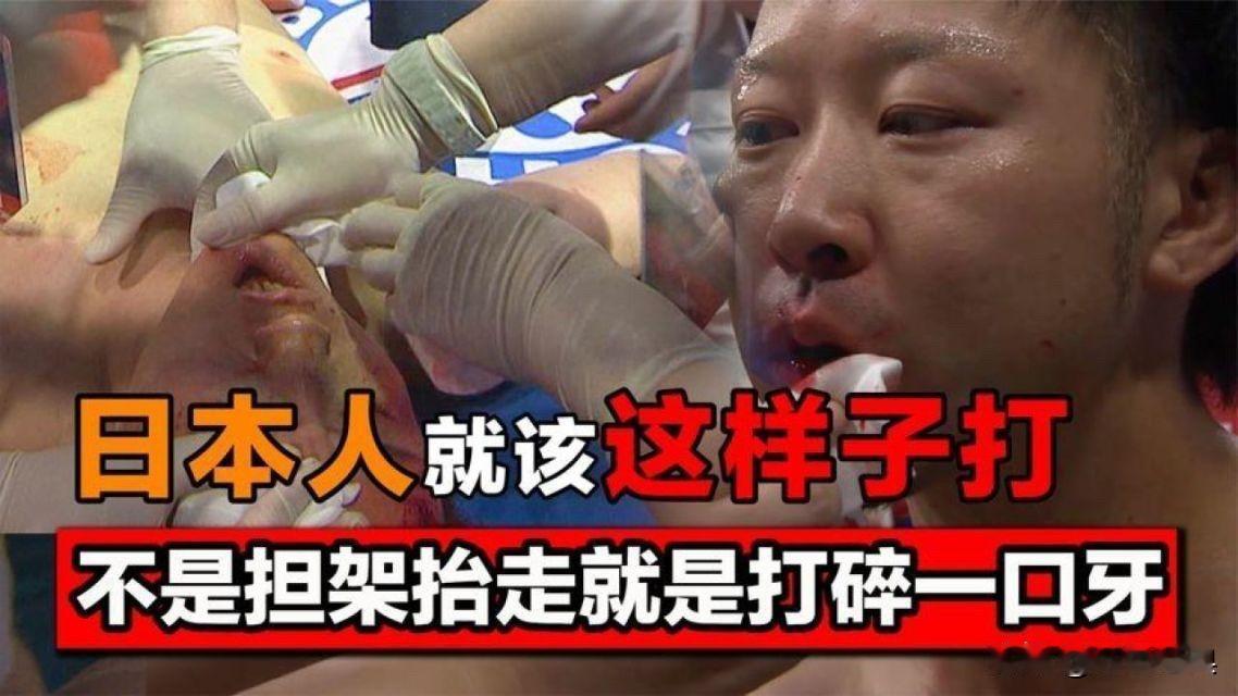 中国外长把话挑明了！

针对日本高市早苗政府的蠢蠢欲动，中国外长在慕尼黑把话挑明