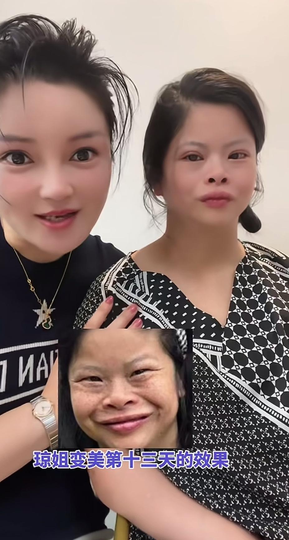琼姐逆袭的很成功，越来越美了。