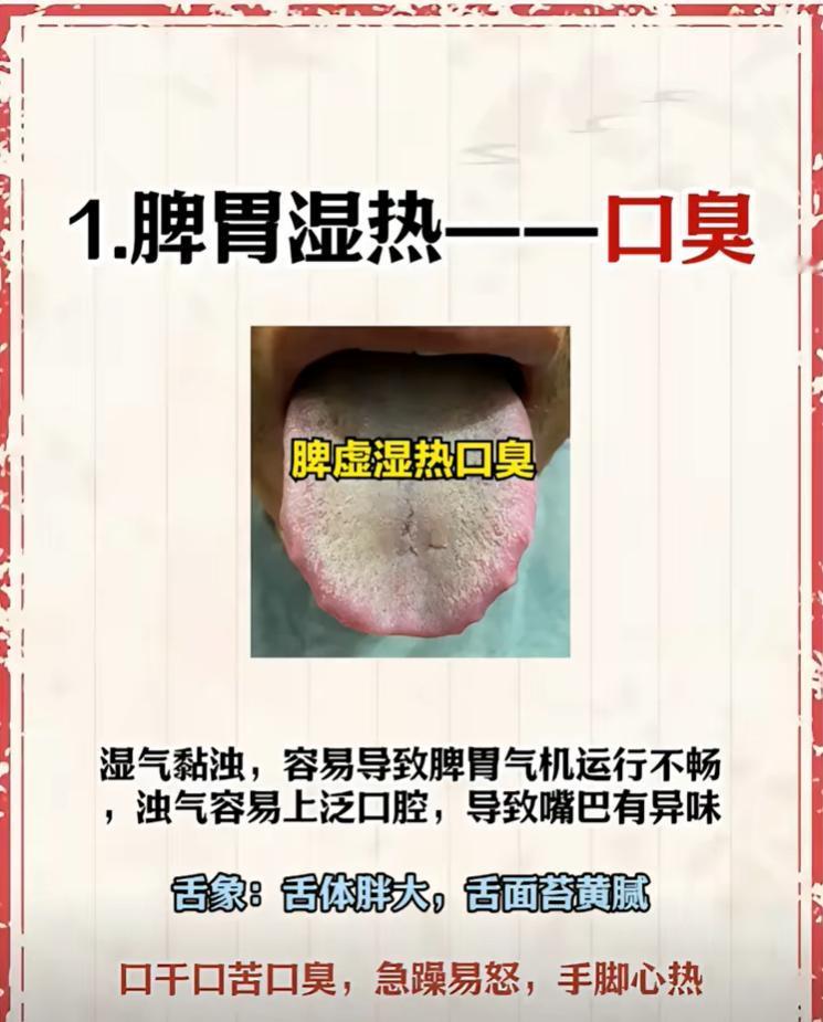 脾胃问题三种常见舌象：脾胃湿热、脾虚气滞、脾虚湿困自查