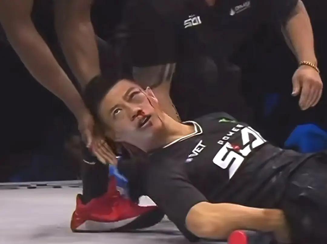 赵洪刚败北的主要原因，就是抗击打能力太差！

通背拳传人赵洪刚在扇耳光大赛上被 