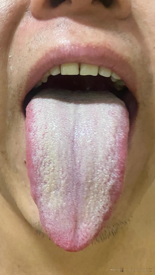 拖啊，你接着拖，我也是真想给你竖个大拇指[赞][赞][赞]
明明已经发现问题，就