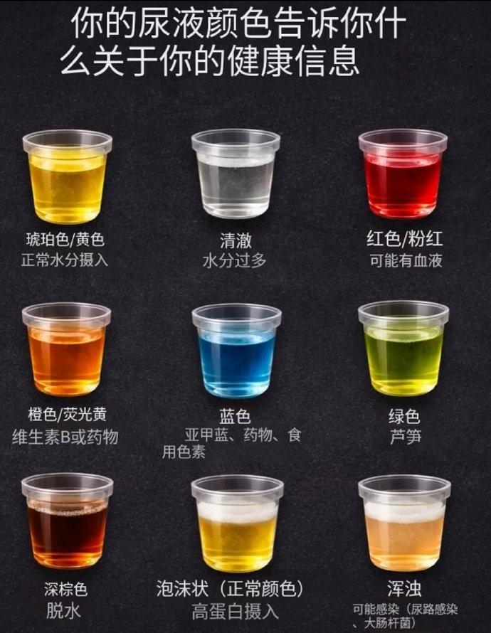 尿液真的是身体状况的 “小喇叭”。从颜色看，它能有多种变化，正常是深琥珀色到浅稻