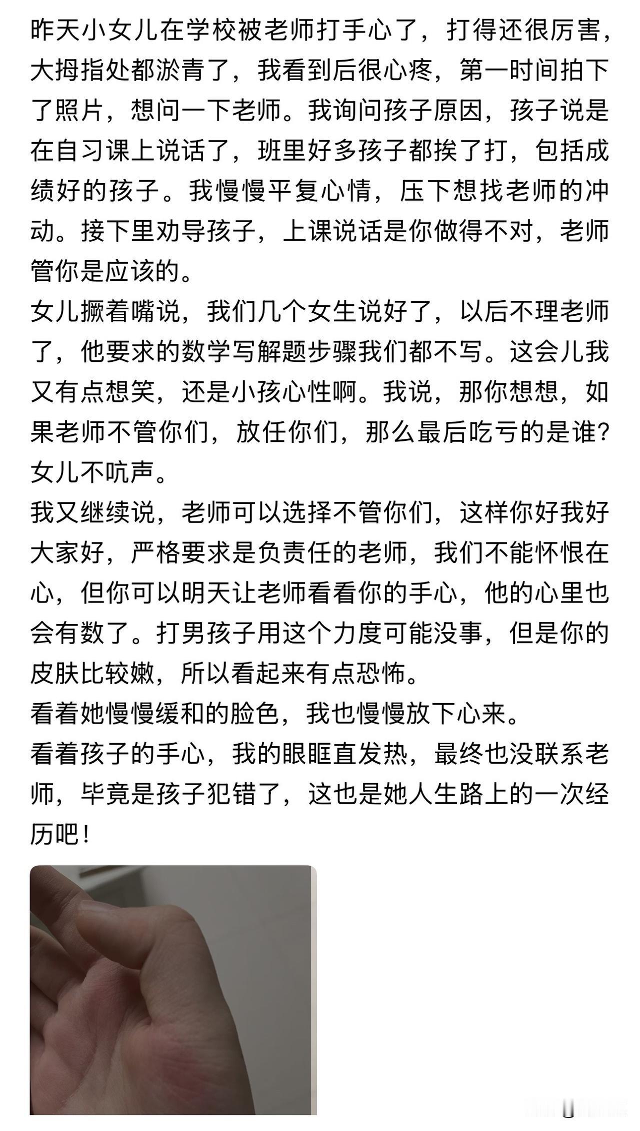 “值得称赞！”这事一位网友的真实故事，女儿被老师打手心，大拇指都淤青了，她不但没