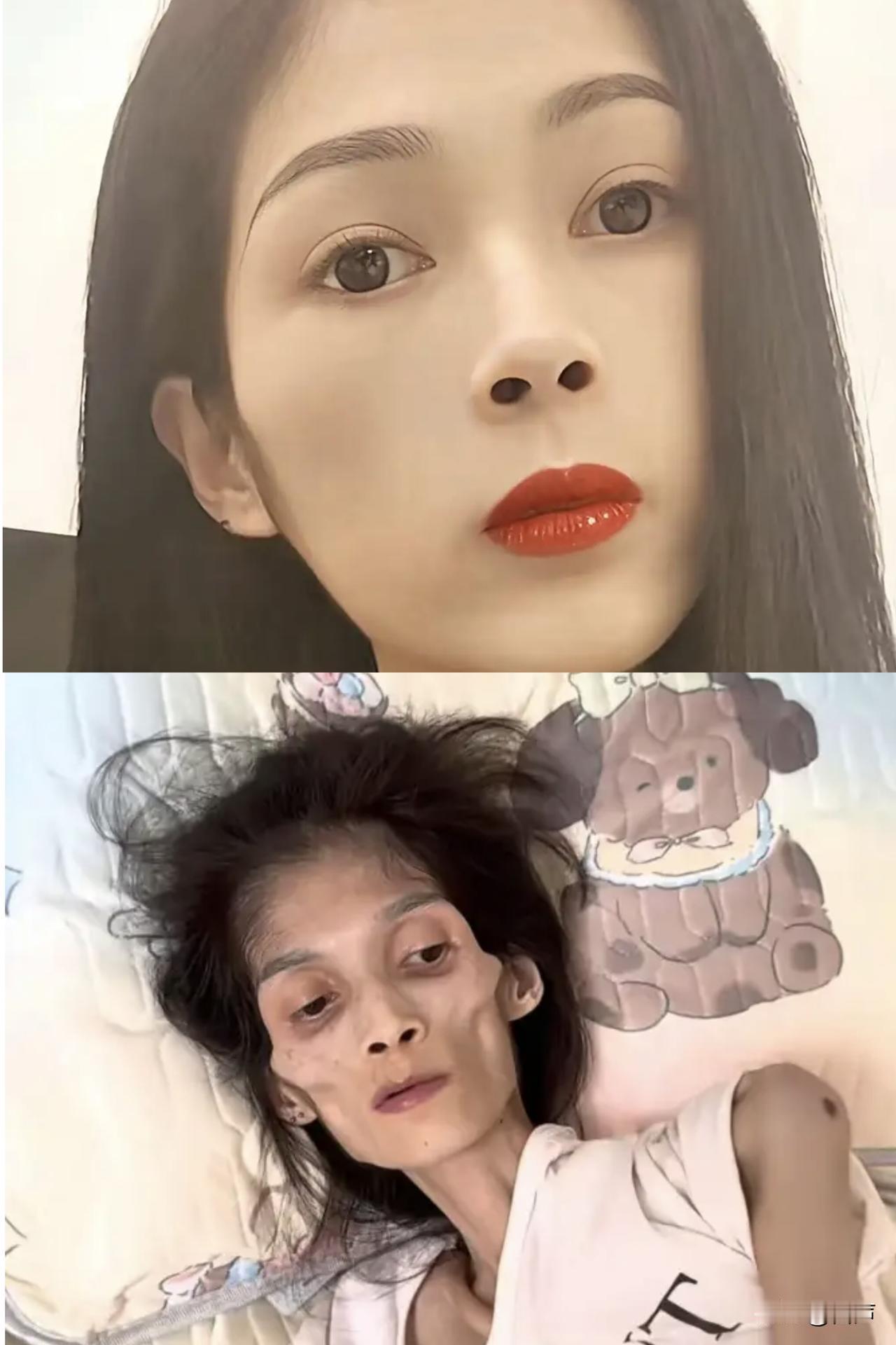 27岁广东女孩“巧巧妹妹”去世
很小时就被妈妈抛弃，父亲因胃癌病逝
“巧巧妹妹”