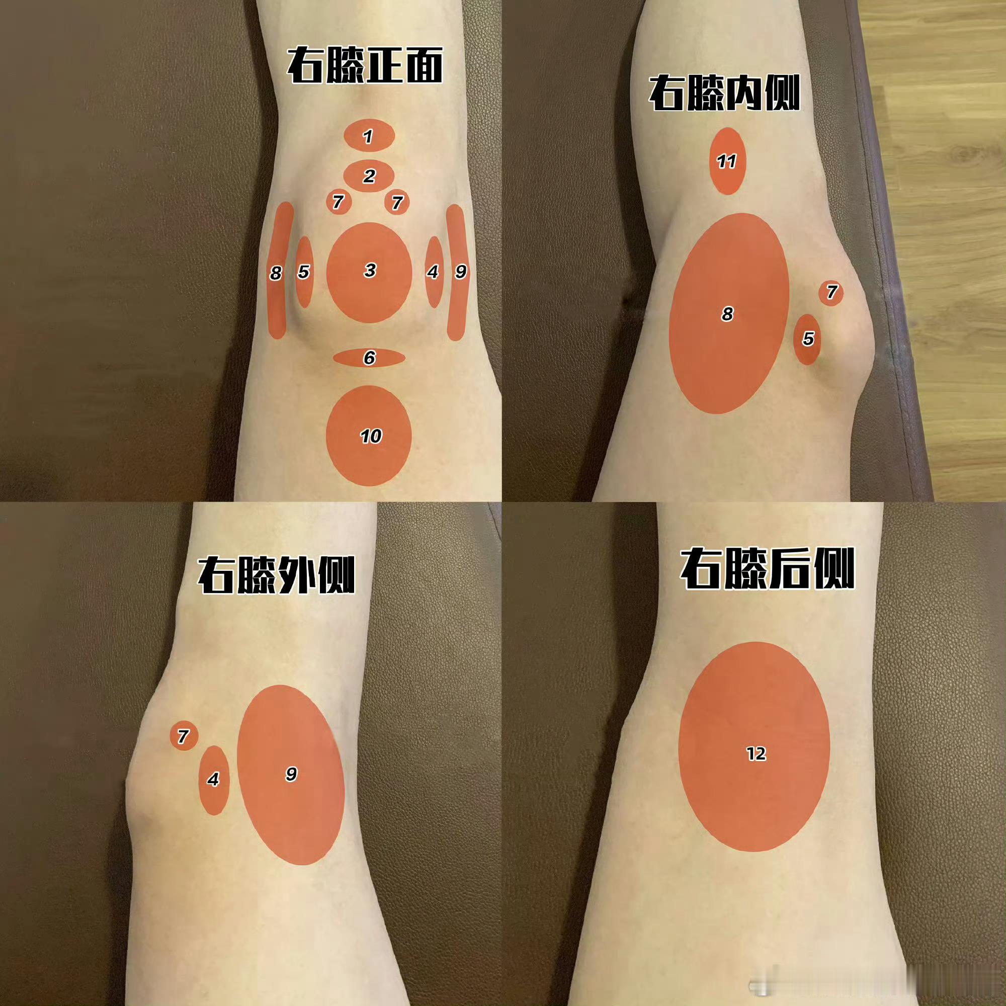 运动康复 在你们老家，“膝盖”用方言怎么说？