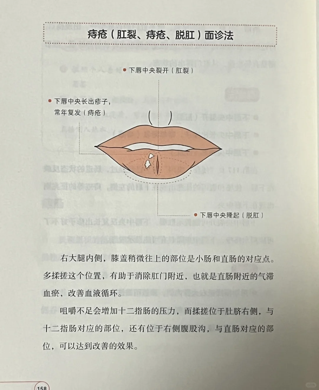 痔疮面诊法及按摩、饮食建议