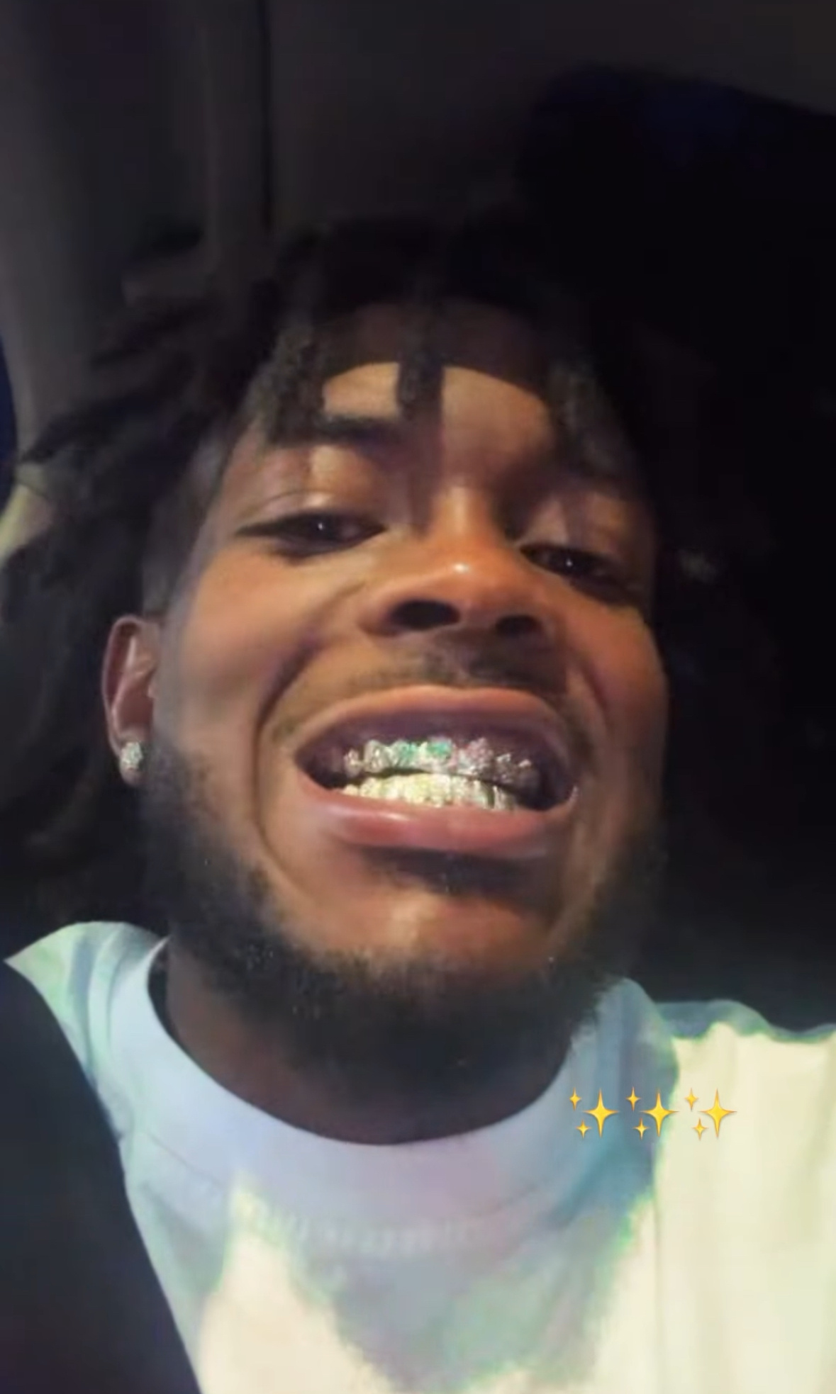 奥利弗更新给牙镶上了钻石👀辽宁男篮 ​​​