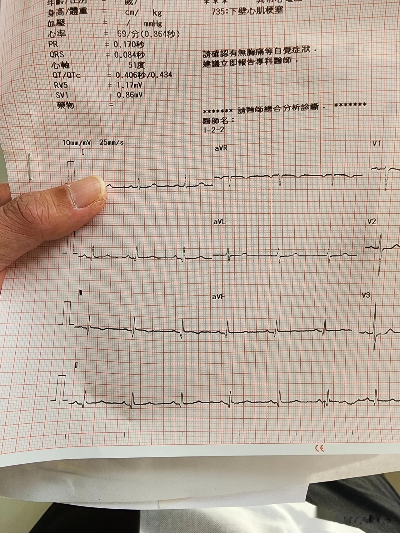 忙着呢，暂时不更新
