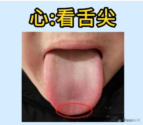 肾阴虚、肾阳虚、寒湿、湿热怎么判断，教你一分钟学会
舌尖——心
发红：心火旺
凹