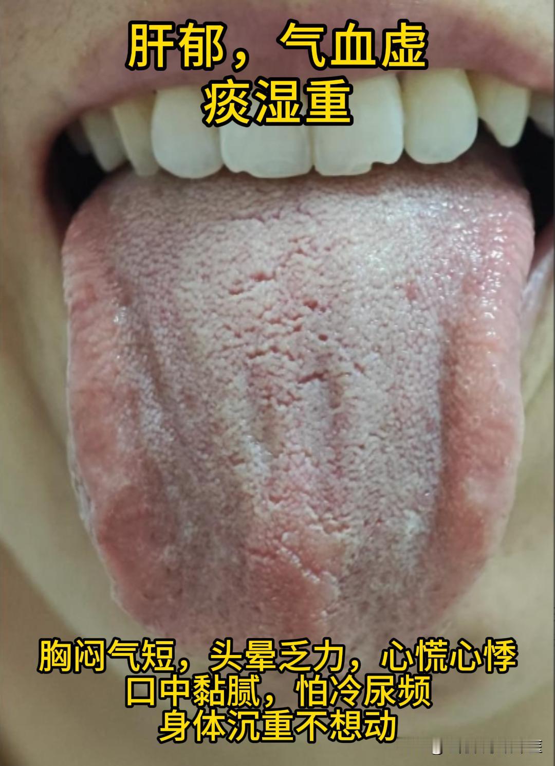 今天有空，可以帮大家看看舌象。
有需要的，尽管把你的舌象照片发过来吧！越早发，我