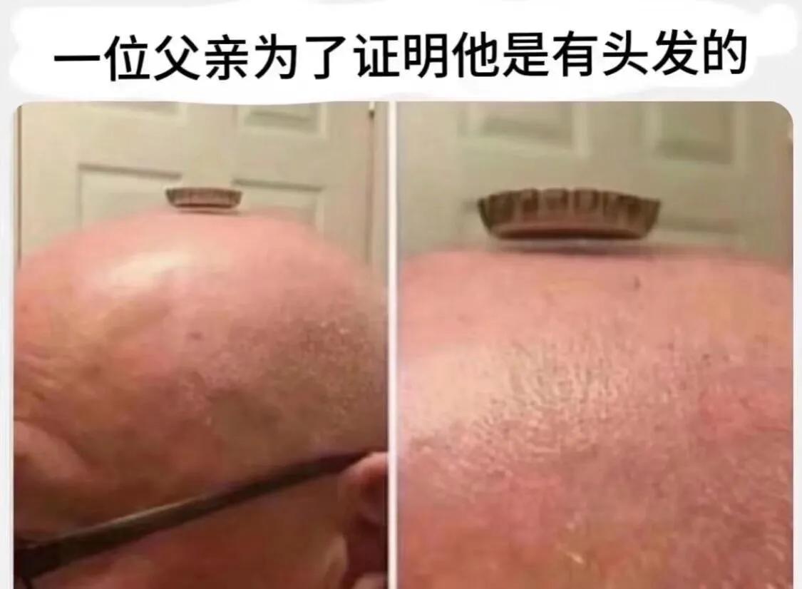 头发唾手可得！！！！
