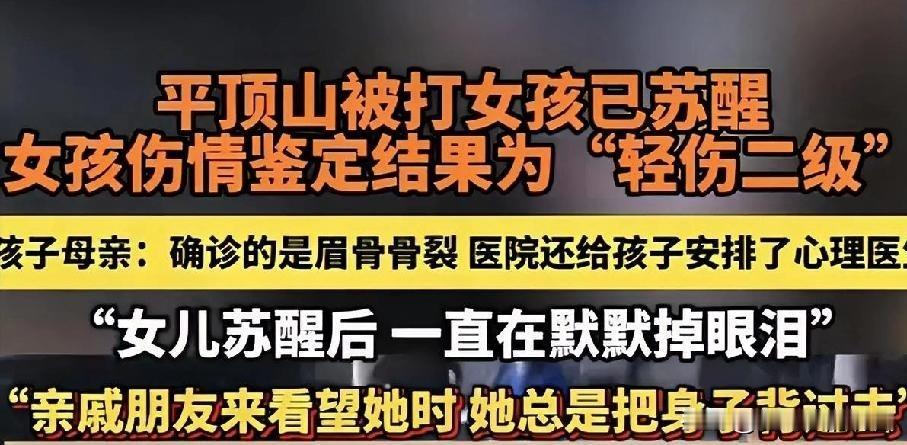 轻伤二级，妥妥的构成刑事犯罪了，这是要吃牢饭的，而且对后辈子女影响深远。
看了两