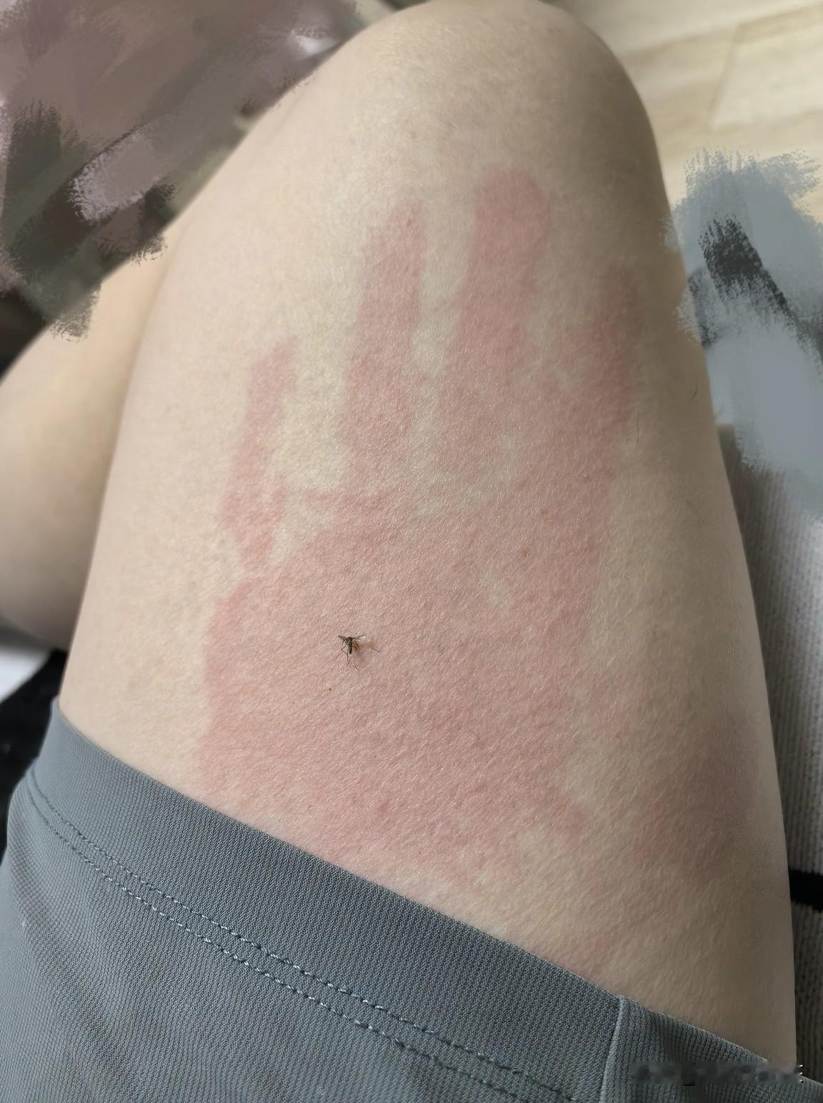 你可认识这掌法？我打蚊子有三招，一个是留全尸，心情好还能做成标本，另一个是真接二