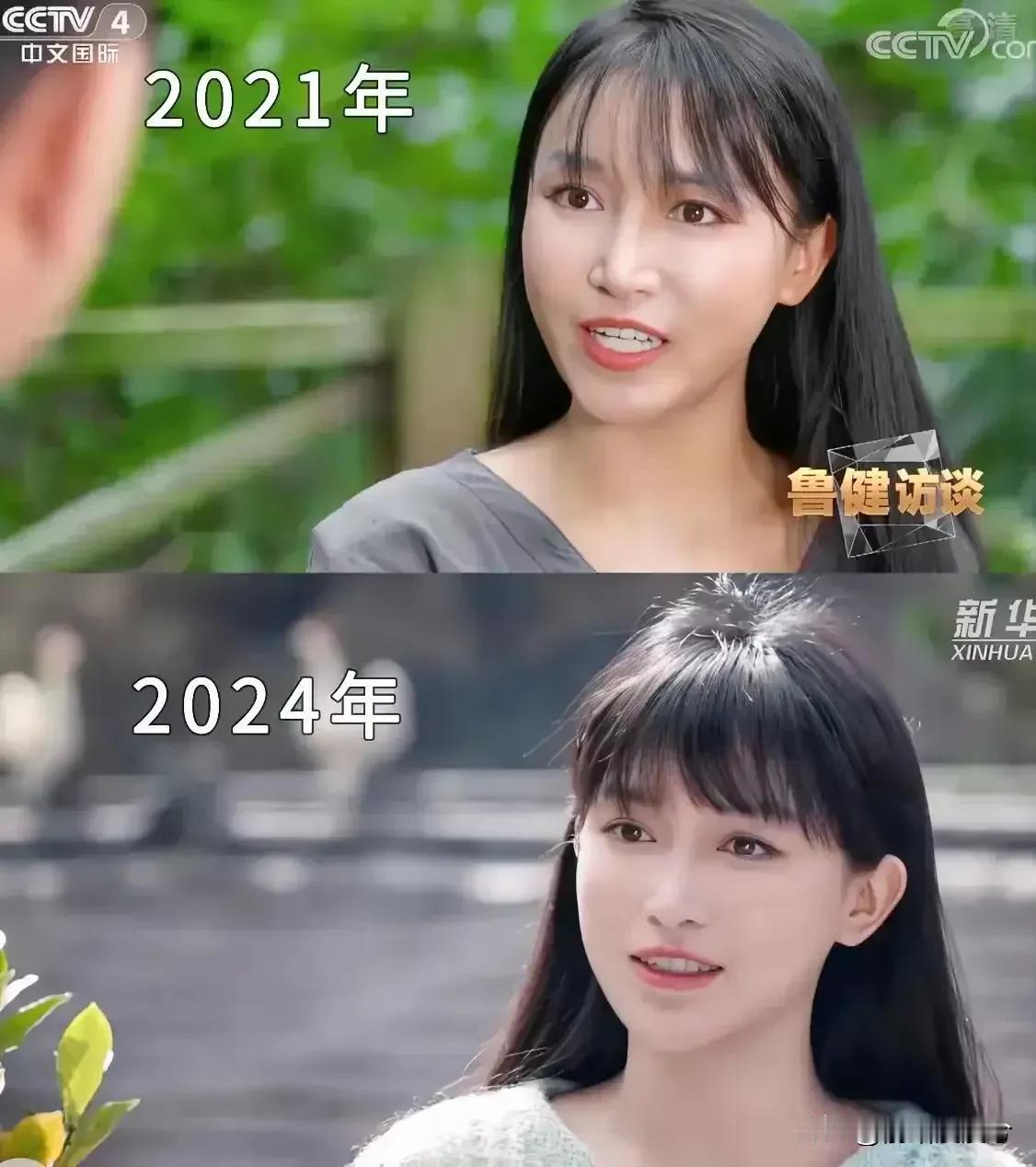 从这两张照片，看得出子柒经过三年的沉淀，整个面相比原来柔和了，松弛了，所以更美了