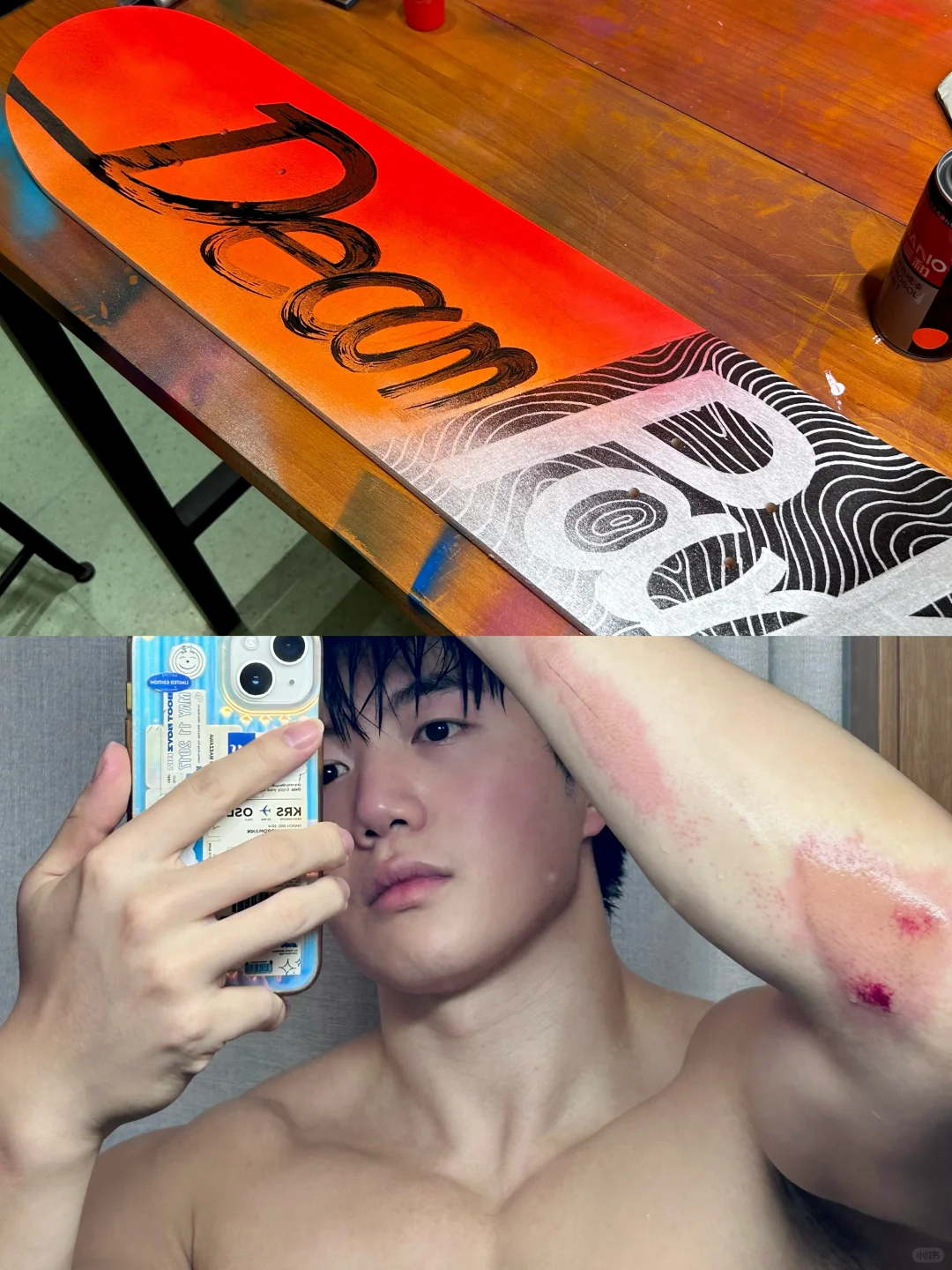 画画的时候伤口就不疼了