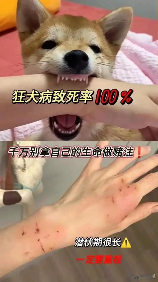 养狗的都看看！你家狗咬你，真不怪它

说实话，狗咬主人这事儿，太常见了。
但你信