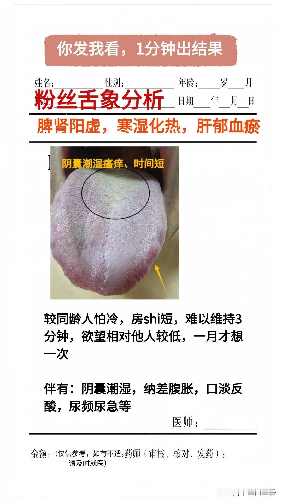 今天分享：脾肾阳虚 寒湿化热 肝郁血瘀
你的舌象是什么情况呢？你发我看，1分钟出