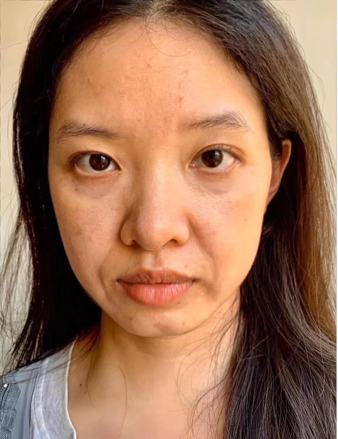 35岁花了两个月工资值吗
容貌焦虑 帮我看看 垮脸 面中年轻化 原相机 日常分享