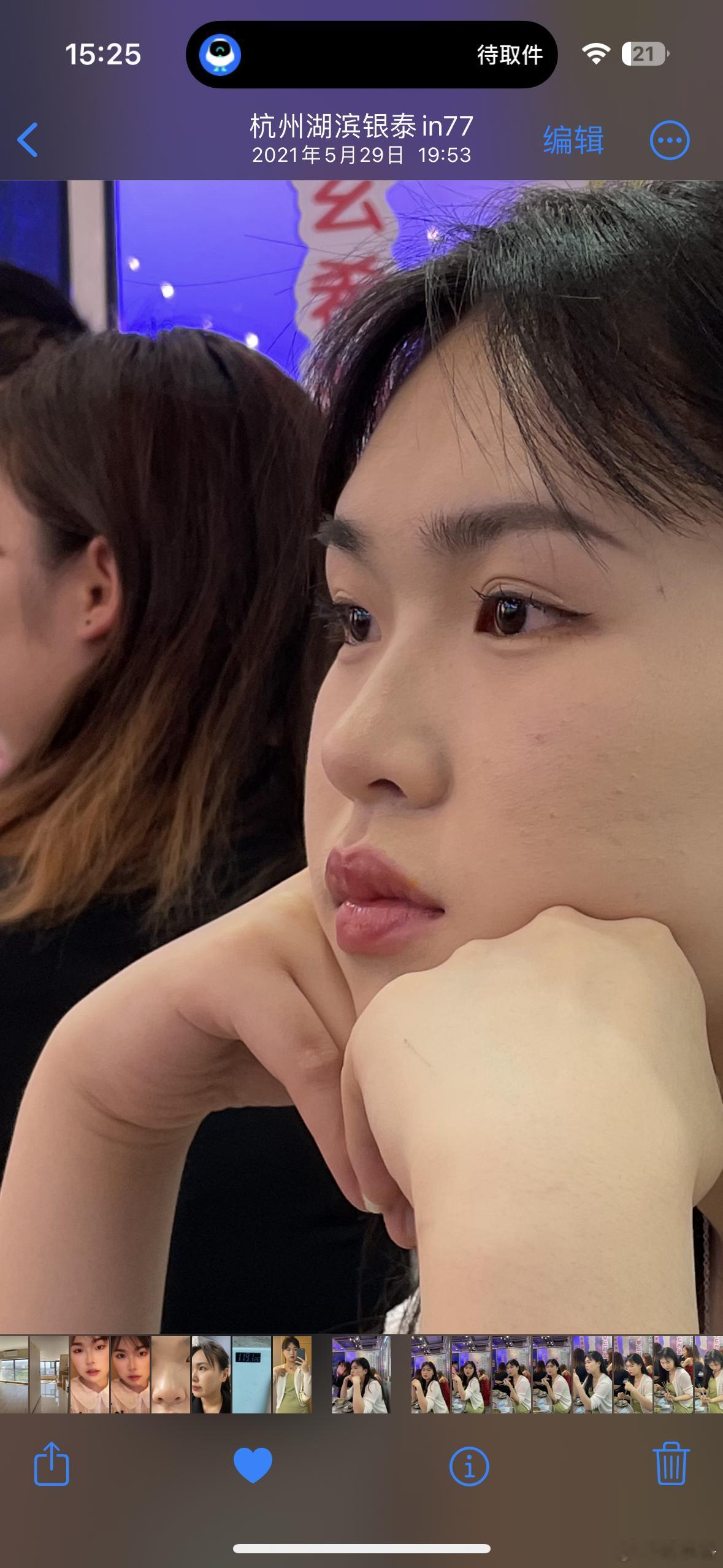 肉脸的女生可以看一下这个我以前瘦那么几天的时候鼻子也有的（p1p2），因为小骨架