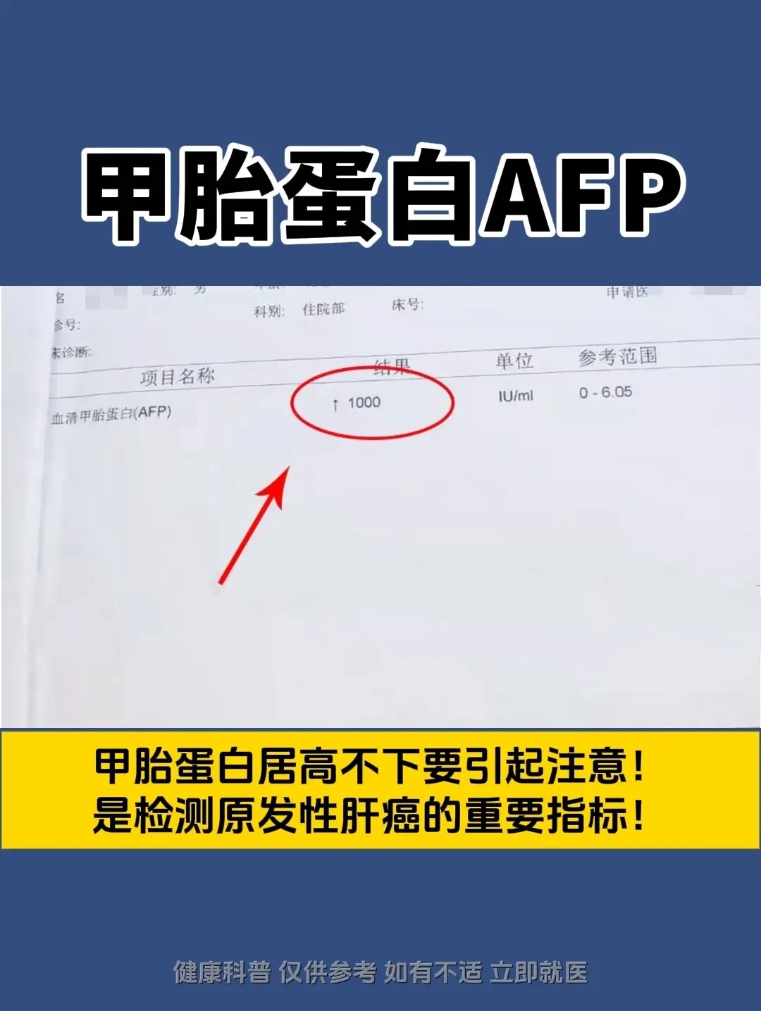 甲胎蛋白诊断原发性肝癌的重要指标！这两天一个菏泽的病号，确诊了肝癌，甲...