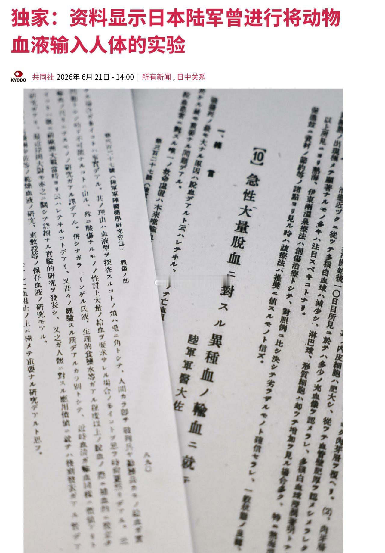 共同社在日本官方组织的“陆军军医团”杂志中发现，日本陆军在中日战争期间，曾存在将