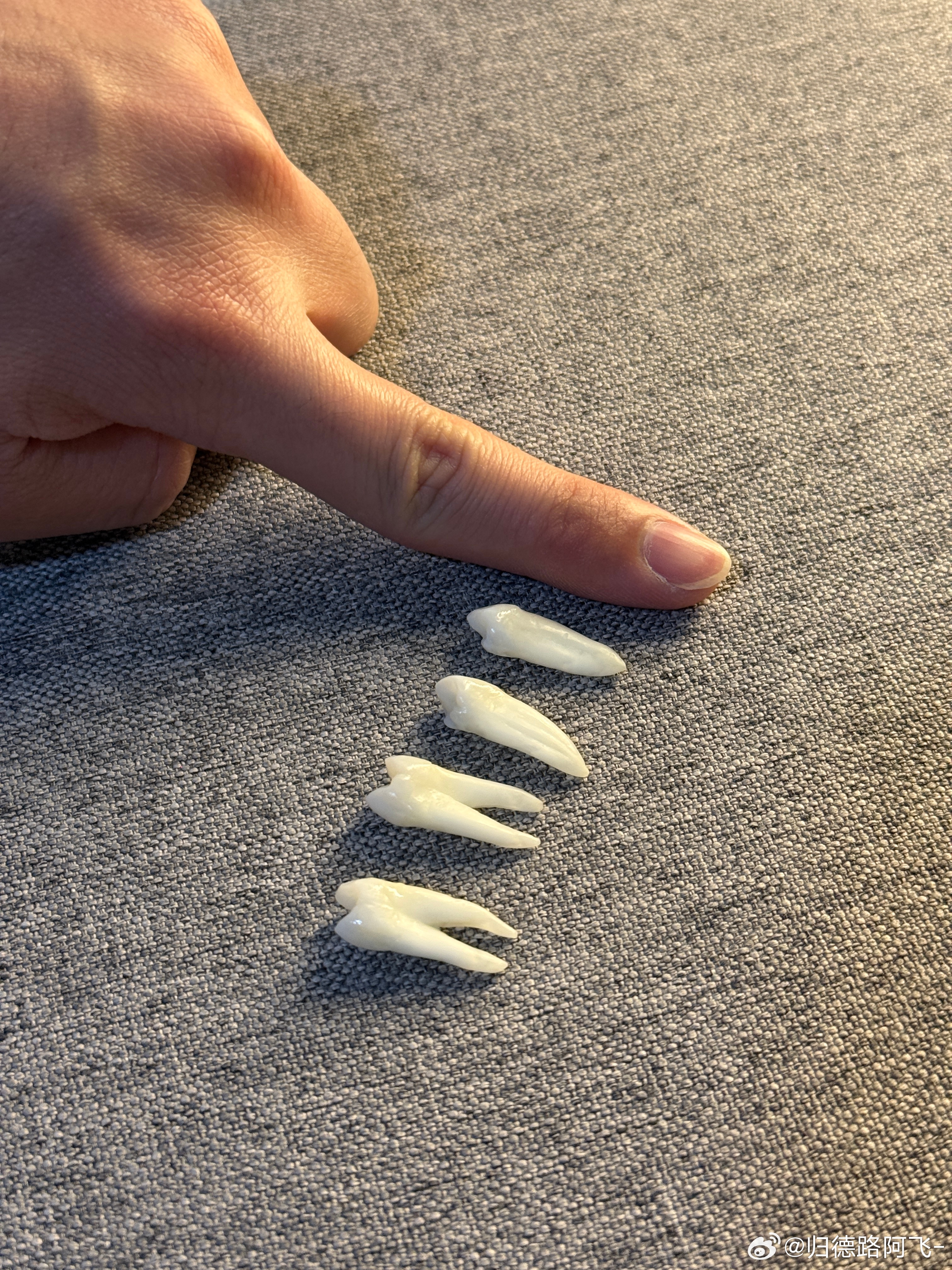 人的牙还是挺长的我带矫正器的时候，需要拔掉四颗健康的牙，现在看到它们，还是很心疼
